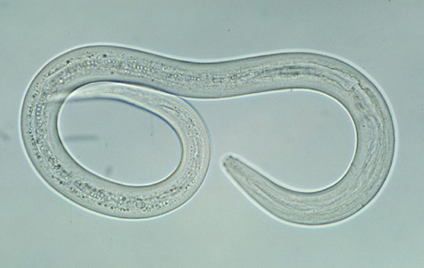 roundworm